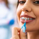 Do Veneers Look And Feel Like Real Teeth?