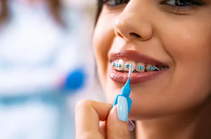 Do Veneers Look And Feel Like Real Teeth?